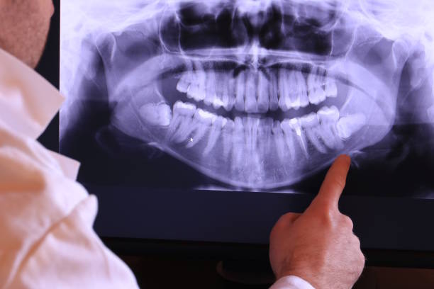Best Emergency Treatment for Oral Infections in Lexington, VA