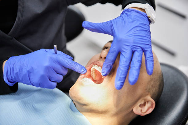 Best Emergency Root Canal Therapy in Lexington, VA